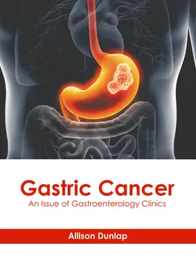 Gyomorrák: A Gastroenterológiai Klinikák száma - Gastric Cancer: An Issue of Gastroenterology Clinics