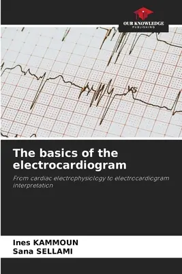 Az elektrokardiogram alapjai - The basics of the electrocardiogram