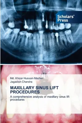 Maxilláris Sinus Lift eljárások - Maxillary Sinus Lift Procedures