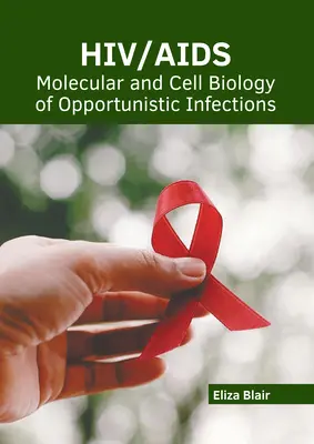 Hiv/Aids: Az opportunista fertőzések molekuláris és sejtbiológiája - Hiv/Aids: Molecular and Cell Biology of Opportunistic Infections