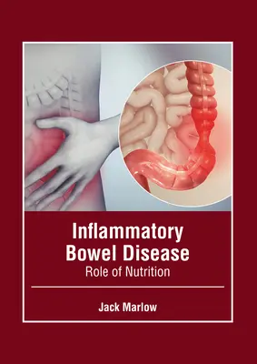 Gyulladásos bélbetegség: A táplálkozás szerepe - Inflammatory Bowel Disease: Role of Nutrition