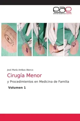 Ciruga Menor
