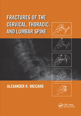 A nyaki, mellkasi és ágyéki gerinc törései - Fractures of the Cervical, Thoracic, and Lumbar Spine