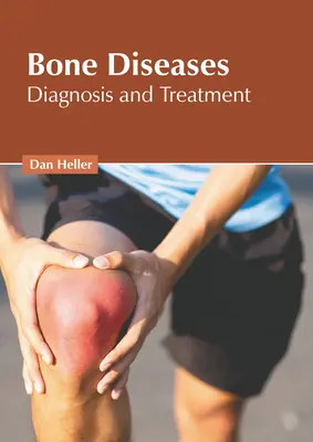 Csontbetegségek: Diagnózis és kezelés - Bone Diseases: Diagnosis and Treatment