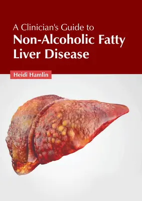 A klinikus útmutatója a nem alkoholos zsírmájbetegséghez - A Clinician's Guide to Non-Alcoholic Fatty Liver Disease