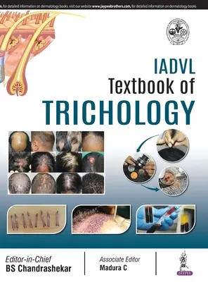 IADVL A trichológia tankönyve - IADVL Textbook of Trichology