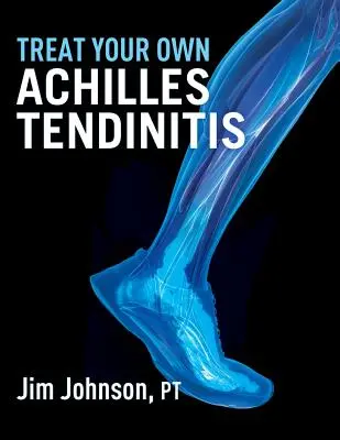 Kezelje saját Achilles-ínhüvelygyulladását - Treat Your Own Achilles Tendinitis