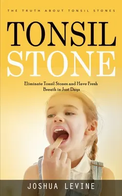 Tonsil Stones: Az igazság a mandulakövekről (Szüntesse meg a mandulaköveket és legyen friss a lehellete néhány nap alatt!) - Tonsil Stones: The Truth about Tonsil Stones (Eliminate Tonsil Stones and Have Fresh Breath in Just Days!)