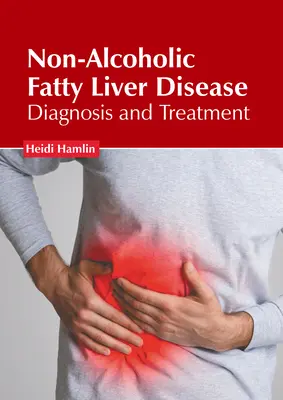 Nem alkoholos zsírmájbetegség: Diagnózis és kezelés - Non-Alcoholic Fatty Liver Disease: Diagnosis and Treatment