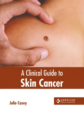 A bőrrák klinikai útmutatója - A Clinical Guide to Skin Cancer