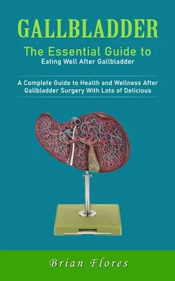 Epehólyag: The Essential Guide to Eating Well After Gallbladder (Az epehólyagműtét után az egészség és a wellness teljes körű útmutatója) - Gallbladder: The Essential Guide to Eating Well After Gallbladder (A Complete Guide to Health and Wellness After Gallbladder Surger