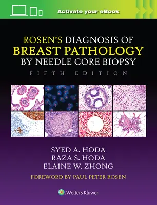 Rosen's Diagnosis of Breast Pathology by Needle Core Biopsy (Az emlőpatológia diagnózisa tűmagbiopsziával) - Rosen's Diagnosis of Breast Pathology by Needle Core Biopsy