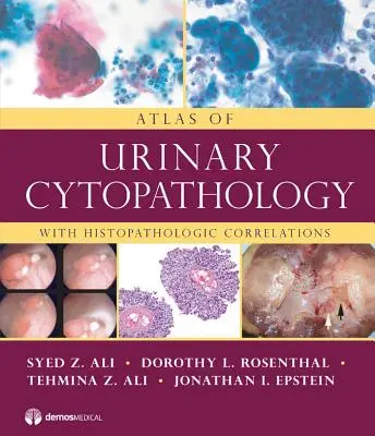 A húgyúti citopatológia atlasza: Hisztopatológiai összefüggésekkel - Atlas of Urinary Cytopathology: With Histopathologic Correlations