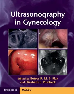 Ultrahangvizsgálat a nőgyógyászatban - Ultrasonography in Gynecology