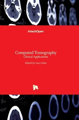 Számítógépes tomográfia: Klinikai alkalmazások - Computed Tomography: Clinical Applications