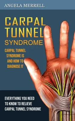 Carpal Tunnel Syndrome: A kéztőalagút-szindróma és annak diagnosztizálása - Carpal Tunnel Syndrome: Carpal Tunnel Syndrome is and How to Diagnose It