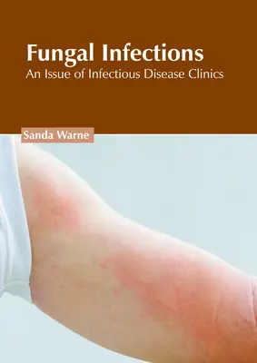 Gombás fertőzések: Infectious Disease Clinics: An Issue of Infectious Disease Clinics - Fungal Infections: An Issue of Infectious Disease Clinics