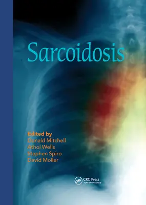 Sarcoidosis