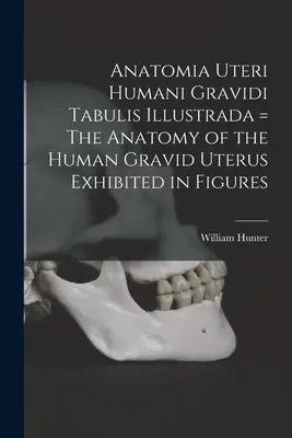 Anatomia Uteri Humani Gravidi Tabulis Illustrada = Az emberi gravid méh anatómiája ábrákon ábrázolva. - Anatomia Uteri Humani Gravidi Tabulis Illustrada = The Anatomy of the Human Gravid Uterus Exhibited in Figures