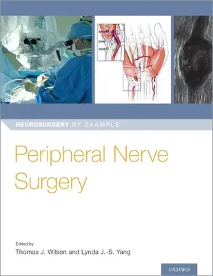 Perifériás idegműtét - Peripheral Nerve Surgery