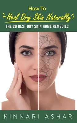 Hogyan gyógyítsuk a száraz bőrt természetes módon: A 20 legjobb száraz bőr házi gyógymód - How to Heal Dry Skin Naturally: The 20 Best Dry Skin Home Remedies
