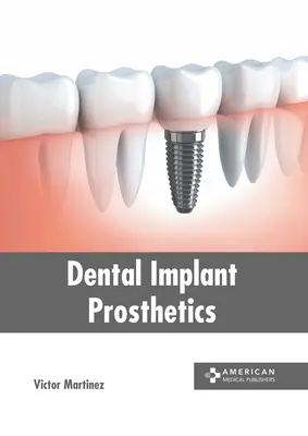 Fogászati implantátumprotézisek - Dental Implant Prosthetics