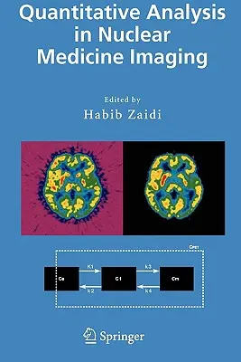 Kvantitatív elemzés a nukleáris medicina képalkotásában - Quantitative Analysis in Nuclear Medicine Imaging