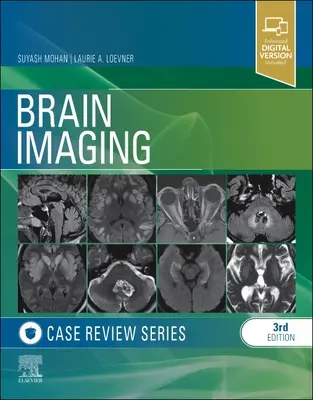 Agyi képalkotó esetek áttekintése - Brain Imaging Case Review