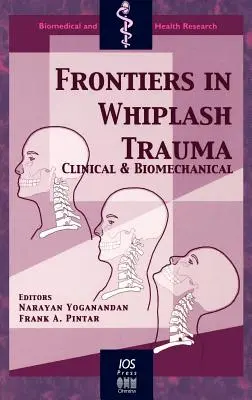 Az ostorcsapás-trauma határai - Frontiers in Whiplash Trauma