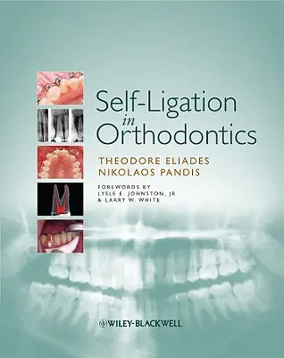 Self-Ligation in Orthodontics: A biomechanika és a kezelés bizonyítékokon alapuló megközelítése - Self-Ligation in Orthodontics: An Evidence-Based Approach to Biomechanics and Treatment