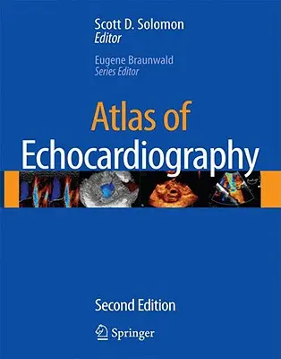 Az echokardiográfia atlasza [CDROM-mal] - Atlas of Echocardiography [With CDROM]