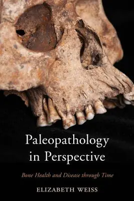 Paleopatológia perspektívában: Csontok egészsége és betegsége az idők folyamán - Paleopathology in Perspective: Bone Health and Disease through Time