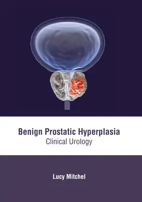 Jóindulatú prosztata hiperplázia: Klinikai urológia - Benign Prostatic Hyperplasia: Clinical Urology