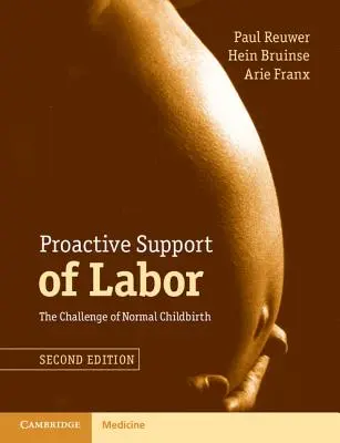 A munkaerő proaktív támogatása: A normális szülés kihívása - Proactive Support of Labor: The Challenge of Normal Childbirth