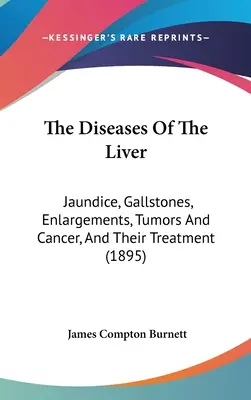 A máj betegségei: Sárgaság, epekövek, megnagyobbodások, daganatok és rák, és kezelésük (1895) - The Diseases Of The Liver: Jaundice, Gallstones, Enlargements, Tumors And Cancer, And Their Treatment (1895)