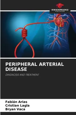 Perifériás artériás betegség - Peripheral Arterial Disease