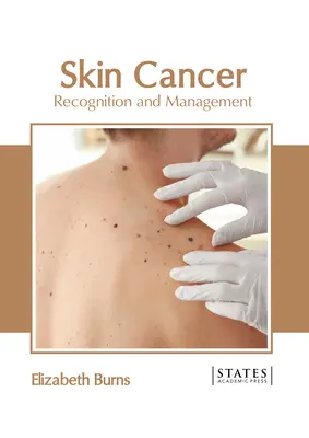 Bőrrák: Felismerés és kezelés - Skin Cancer: Recognition and Management