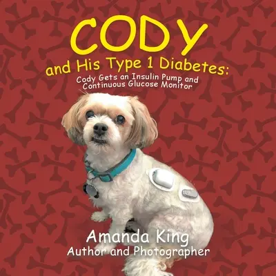 Cody és az 1-es típusú cukorbetegsége: Cody inzulinpumpát és folyamatos glükózmonitort kap - Cody and His Type 1 Diabetes: Cody Gets an Insulin Pump and Continuous Glucose Monitor