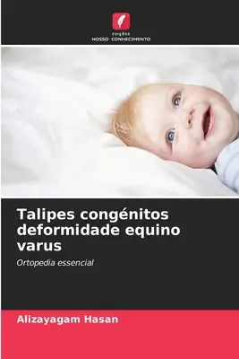 Talipes congnitos deformidade equino varus