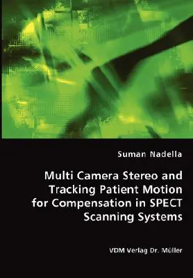 Többkamerás sztereó és a beteg mozgásának követése a SPECT-szkennelő rendszerek kompenzálásához - Multi Camera Stereo and Tracking Patient Motion for Compensation in SPECT Scanning Systems