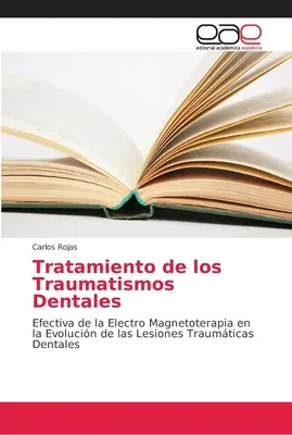 Tratamiento de los Traumatismos Dentales (Fogászati traumák kezelése) - Tratamiento de los Traumatismos Dentales