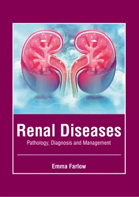 Vesebetegségek: Veseelégtelenség: patológia, diagnózis és kezelés - Renal Diseases: Pathology, Diagnosis and Management