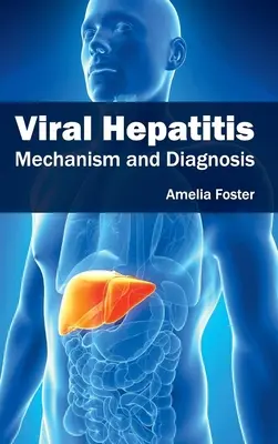 Vírusos hepatitis: Hepatitisz: Mechanizmus és diagnózis - Viral Hepatitis: Mechanism and Diagnosis