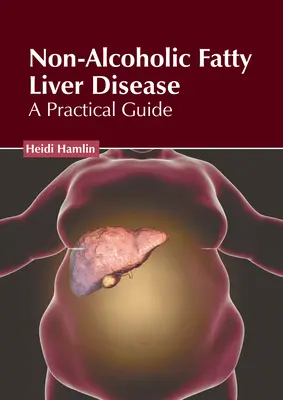 Nem alkoholos zsírmájbetegség: Gyakorlati útmutató - Non-Alcoholic Fatty Liver Disease: A Practical Guide