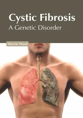 Cisztás fibrózis: A genetikai rendellenesség - Cystic Fibrosis: A Genetic Disorder