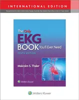 Az egyetlen EKG-könyv, amire valaha is szüksége lesz - Only EKG Book You'll Ever Need