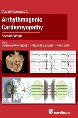 Az aritmogén kardiomiopátia jelenlegi koncepciói, második kiadás - Current Concepts in Arrhythmogenic Cardiomyopathy, Second Edition