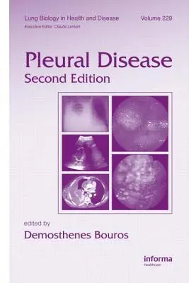 Mellhártyabetegség - Pleural Disease