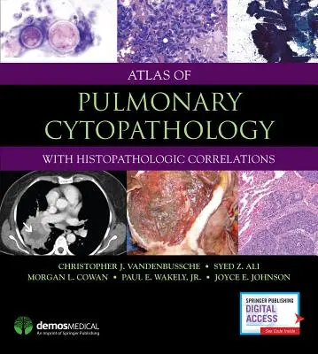 A tüdő citopatológiai atlasza - Atlas of Pulmonary Cytopathology