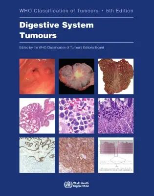 Emésztőrendszeri daganatok: A daganatok osztályozása - Digestive System Tumours: Who Classification of Tumours